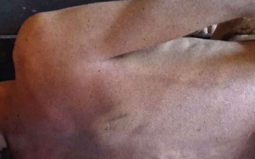 US report points to credible information that government officials employ torture under the state of exception in El Salvador — Hay información creíble de que funcionarios gubernamentales emplean tortura en el régimen de excepción, señala informe de EE.UU