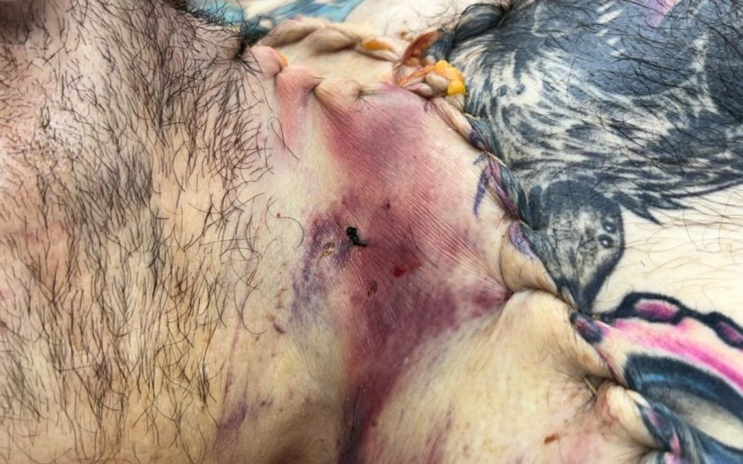 Cristosal Asks Attorney General’s Office to Investigate Possible Torture of Alejandro Muyshondt — Cristosal pide a Fiscalía investigar posible tortura de Alejandro Muyshondt