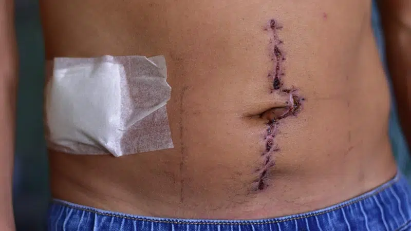 Police Sergeant Beat a Man for "Making Noise" at Night