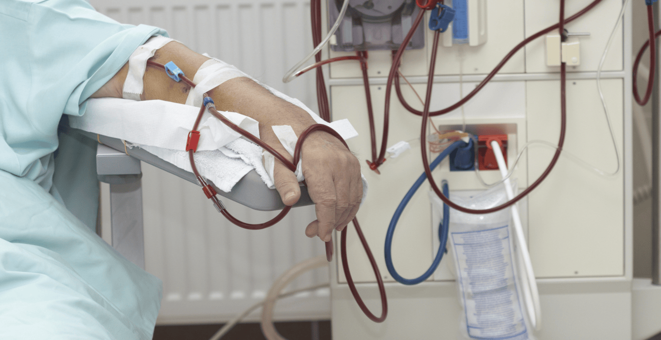 SIMETRISSS: Social Security Institute Has Not Performed Kidney Transplants in Four Months — SIMETRISSS: hace cuatro meses no se realizan trasplantes renales en el Seguro Social