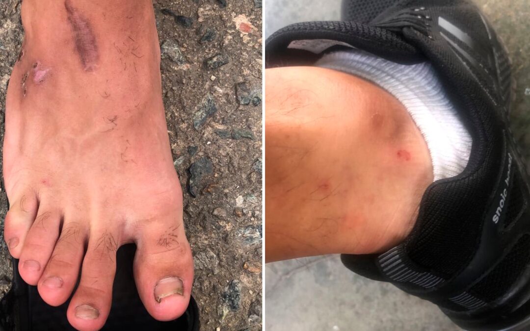 Venezuelans deported to Bukele’s mega-prison reveal torture and other abuses: ‘They said we would only leave in a black bag’ — Los venezolanos deportados a la cárcel de Bukele revelan torturas y violaciones: “Decían que solo saldríamos en una bolsa negra”